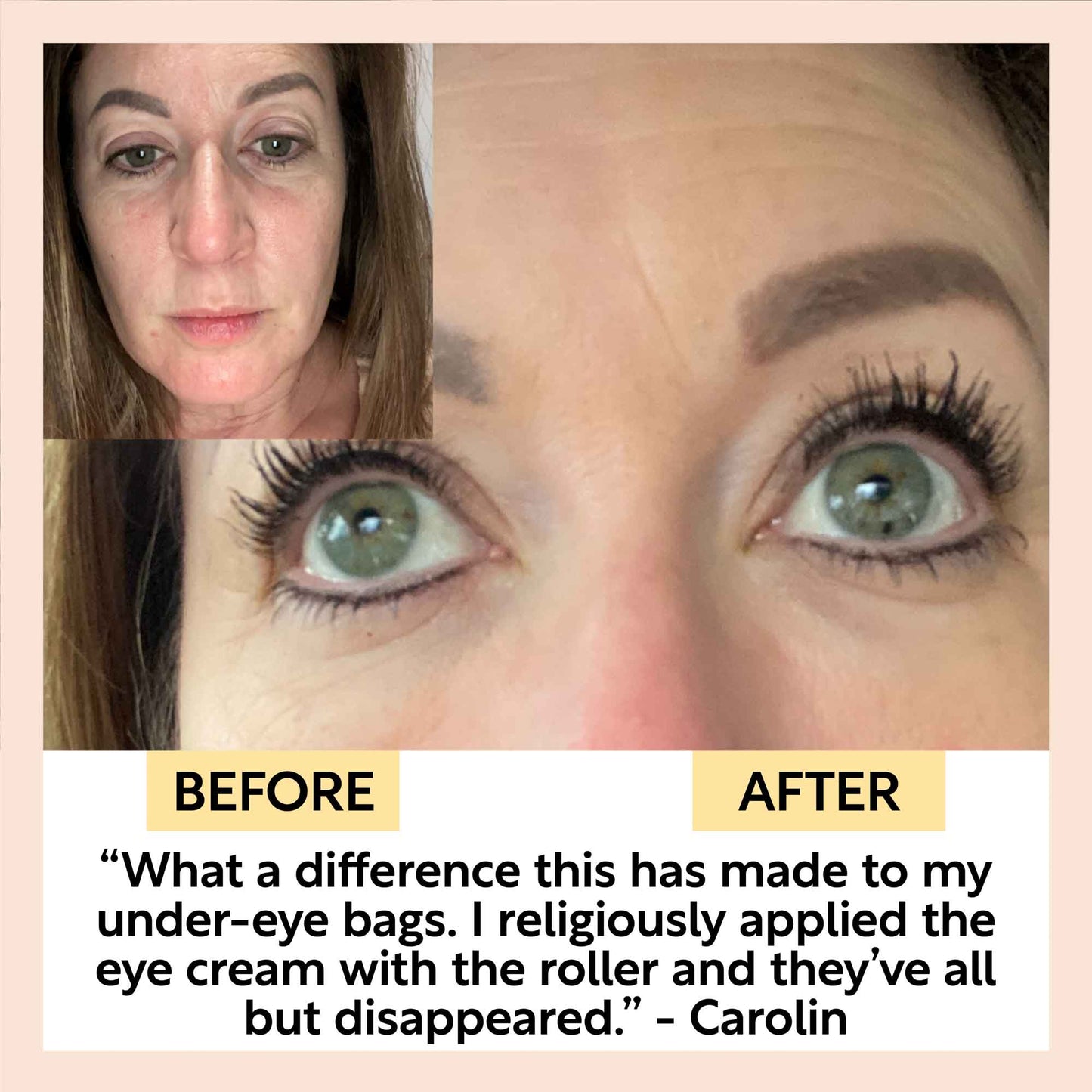 Eye Cream with Hyaluronic Acid & Coffee