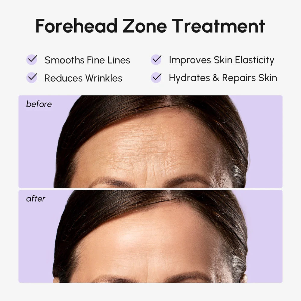 Anti-Wrinkle Forehead Patches - Midnight Petal